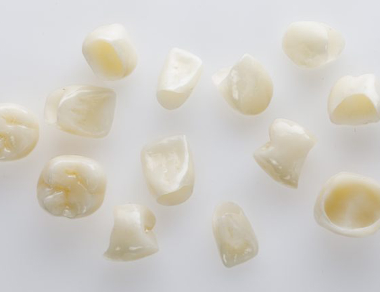 御茶ノ水デンタルクリニックで、保険で白い歯を