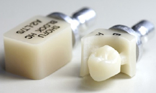 >CAD/CAM冠・インレー