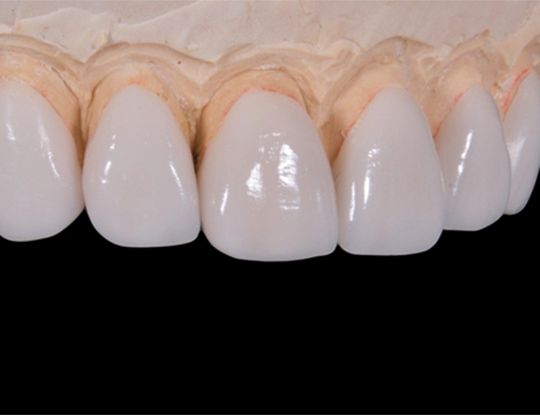 御茶ノ水デンタルクリニックで、保険で白い歯を