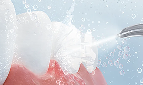 歯のクリーニング