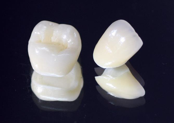 御茶ノ水デンタルクリニックで、保険で白い歯を